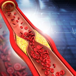 холестерин